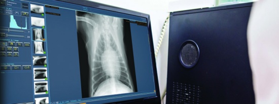 Comment fonctionne la radiologie numérique ?